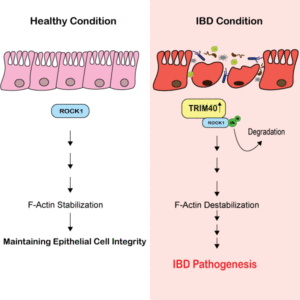 IBD-Pathogenese